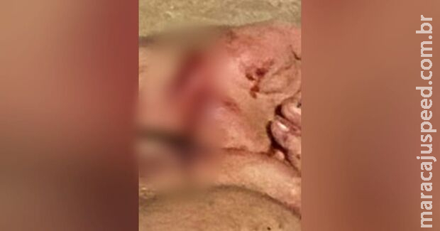 Homem tenta suicídio ao cortar os pulsos e é salvo por policiais militares no Aero Rancho Homem tenta suicídio ao cortar os pulsos e é salvo por policiais militares no Aero Rancho