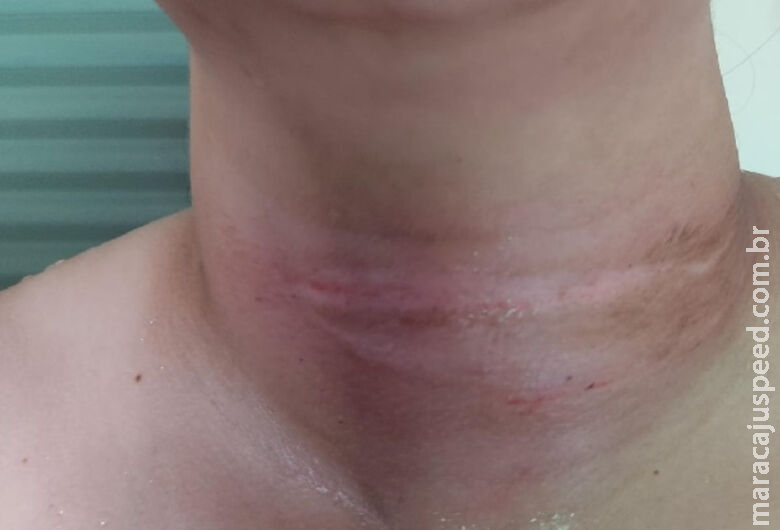 Motociclista escapa da morte ao ter fio de internet enrolado no pescoço