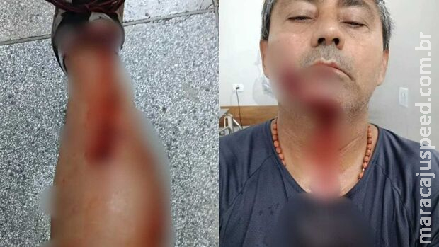 Pitbulls causam temor em Cassilândia após ataque que deixou três pessoas feridas Pitbulls causam temor em Cassilândia após ataque que deixou três pessoas feridas