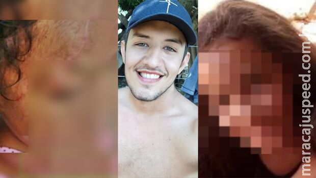 Criança espancada e queimada pelo ex-padrasto teve braço, perna e dedos amputados Criança espancada e queimada pelo ex-padrasto teve braço, perna e dedos amputados