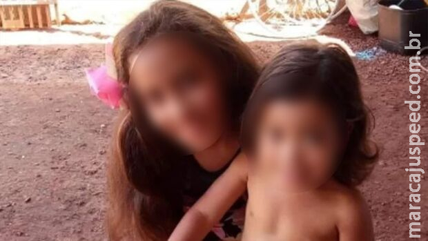 Crianças queimadas em incêndio em Sidrolândia devem passar por novas cirurgias