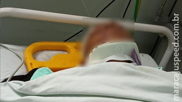 Adolescente atropelado em Nova Andradina teve afundamento de crânio Adolescente atropelado em Nova Andradina teve afundamento de crânio