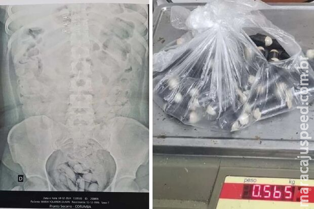 Exército prende boliviano com 53 capsulas de cocaína no estômago em MS