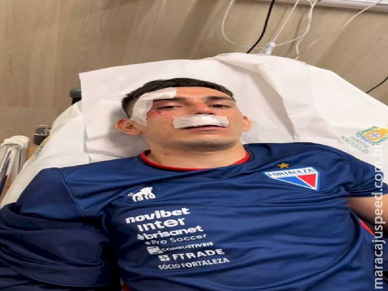 Fortaleza detalha situação de jogadores levados ao hospital após atentado Fortaleza detalha situação de jogadores levados ao hospital após atentado