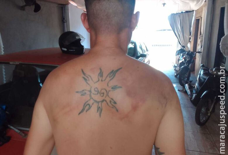 Homem é sequestrado, torturado e sofre tentativa de homicídio em Dourados Homem é sequestrado, torturado e sofre tentativa de homicídio em Dourados
