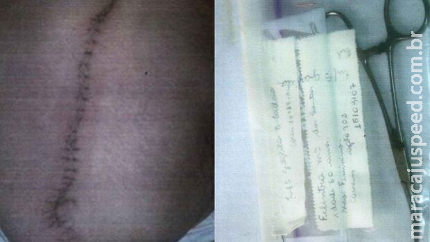 Médico é condenado por esquecer pinça na barriga de paciente em Costa Rica