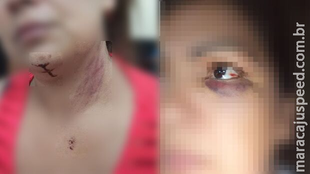 Moradora é espancada pelo vizinho após briga por causa de crianças no Centenário