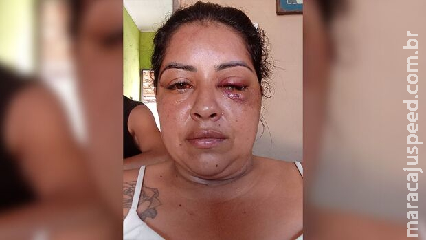 Mulher é espancada, estuprada e mantida em cárcere pelo namorado no Jardim Noroeste Mulher é espancada, estuprada e mantida em cárcere pelo namorado no Jardim Noroeste