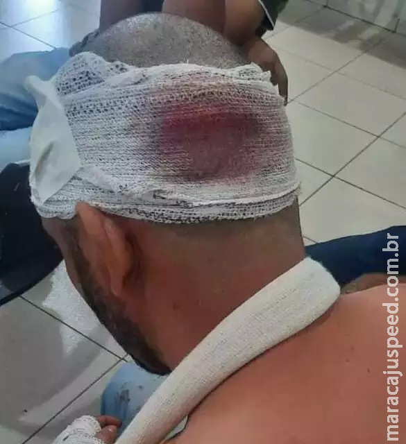 Auxiliar de serviços gerais acusa policial de espancamento durante abordagem Auxiliar de serviços gerais acusa policial de espancamento durante abordagem