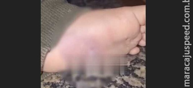 Bebê de 1 ano é espancado e queimado pelos pais no Amazonas
