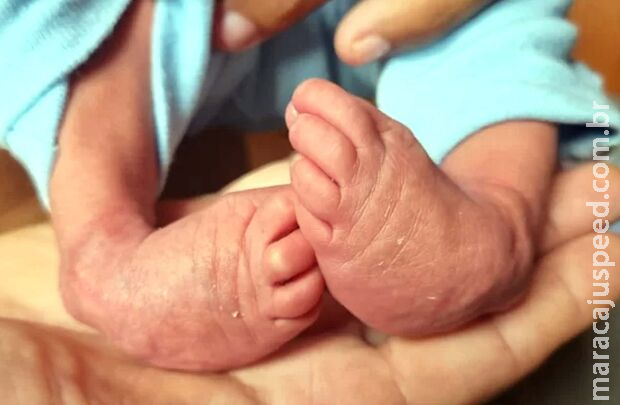 Casal precisa de ajuda para tratamento e cirurgia de bebê com pé congênito em Fátima do Sul Casal precisa de ajuda para tratamento e cirurgia de bebê com pé congênito em Fátima do Sul