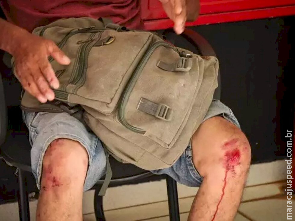 Pedreiro é espancado e anda mais de 20 km até chegar à polícia em MS Pedreiro é espancado e anda mais de 20 km até chegar à polícia em MS