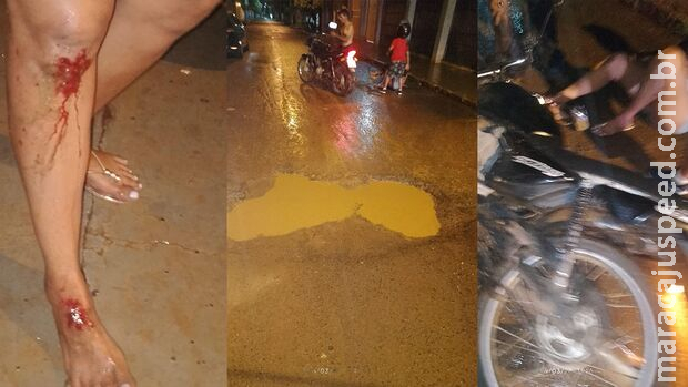 Água da chuva camufla buraco e deixa moradora ferida em Aparecida do Taboado Água da chuva camufla buraco e deixa moradora ferida em Aparecida do Taboado