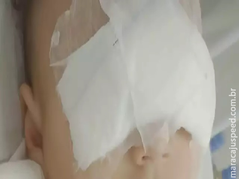 Causa de cegueira infantil, catarata congênita é alvo de inquérito em MS Causa de cegueira infantil, catarata congênita é alvo de inquérito em MS