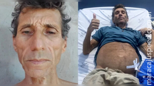 Família cria vaquinha para tratamento de homem com tumor e Família cria vaquinha para tratamento de homem com tumor e