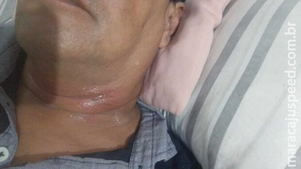 Fio de internet enrosca no pescoço e deixa motociclista de aplicativo ferido no Jardim Colúmbia Fio de internet enrosca no pescoço e deixa motociclista de aplicativo ferido no Jardim Colúmbia