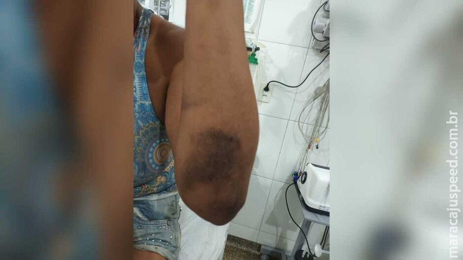Homem coloca mulher para fora de casa e incendeia corpo dela em Água Clara Homem coloca mulher para fora de casa e incendeia corpo dela em Água Clara