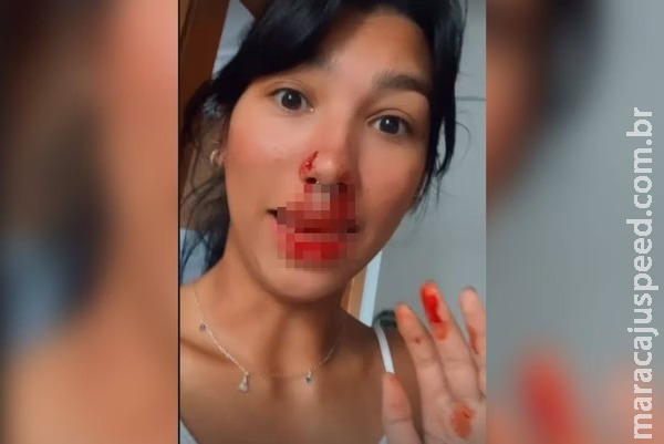 Jovem nega dinheiro a morador de rua e leva soco na cara no DF Jovem nega dinheiro a morador de rua e leva soco na cara no DF