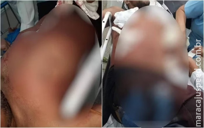Homem é morto por passar a mão nas nádegas de mulher em bar Homem é morto por passar a mão nas nádegas de mulher em bar