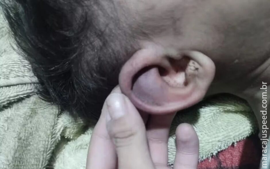 Polícia investiga se bebê de 1 ano sofreu tortura Polícia investiga se bebê de 1 ano sofreu tortura