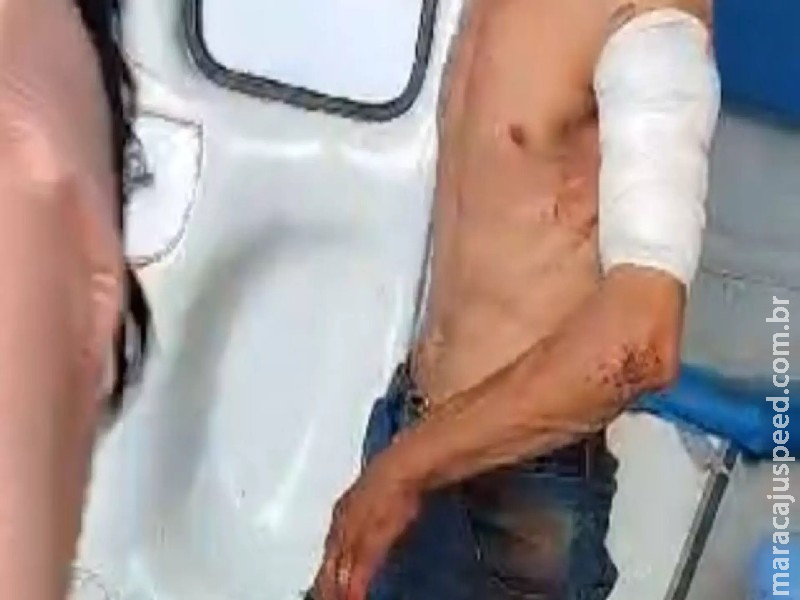 Homem é esfaqueado pela ex-sogra da esposa em Anastácio Homem é esfaqueado pela ex-sogra da esposa em Anastácio