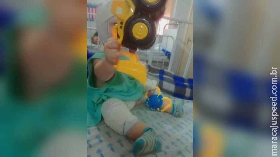 Mãe e filho queimados com tacho recebem alta, mas Silvia ainda precisa de mais uma cirurgia Mãe e filho queimados com tacho recebem alta, mas Silvia ainda precisa de mais uma cirurgia