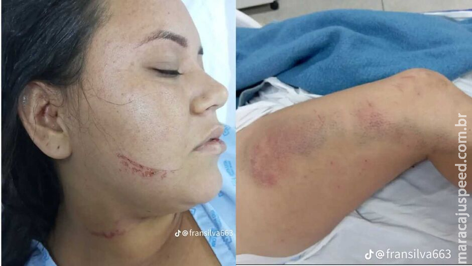 Sobrevivente de atentado nega ter filho com o assassino da amiga em São Gabriel do Oeste Sobrevivente de atentado nega ter filho com o assassino da amiga em São Gabriel do Oeste