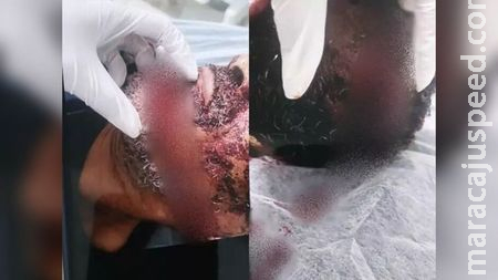 Homem é esfaqueado e tem mão amputada pela ex-mulher em Três Lagoas Homem é esfaqueado e tem mão amputada pela ex-mulher em Três Lagoas