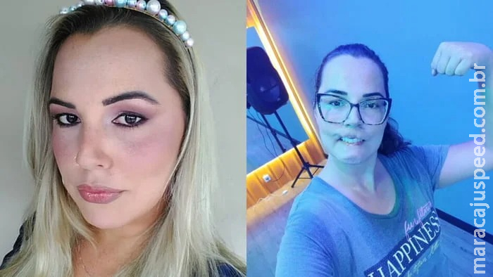 Influencer que perdeu lábio após harmonização usa retalho da língua para novo enxerto Influencer que perdeu lábio após harmonização usa retalho da língua para novo enxerto