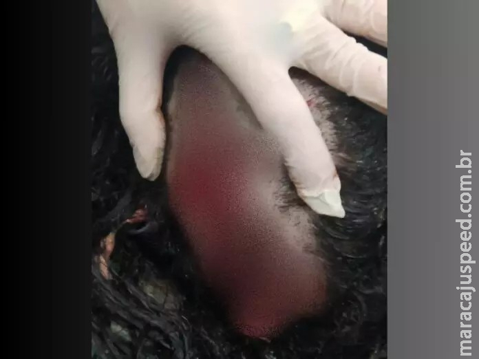 Moradora é espancada com pedaços de pau e tem cabelo arrancado ao oferecer comida para estranho