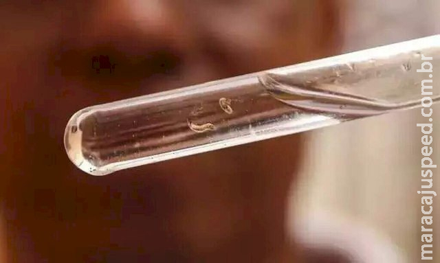 MS bate 15 mil casos confirmados de dengue em semana sem mortes MS bate 15 mil casos confirmados de dengue em semana sem mortes