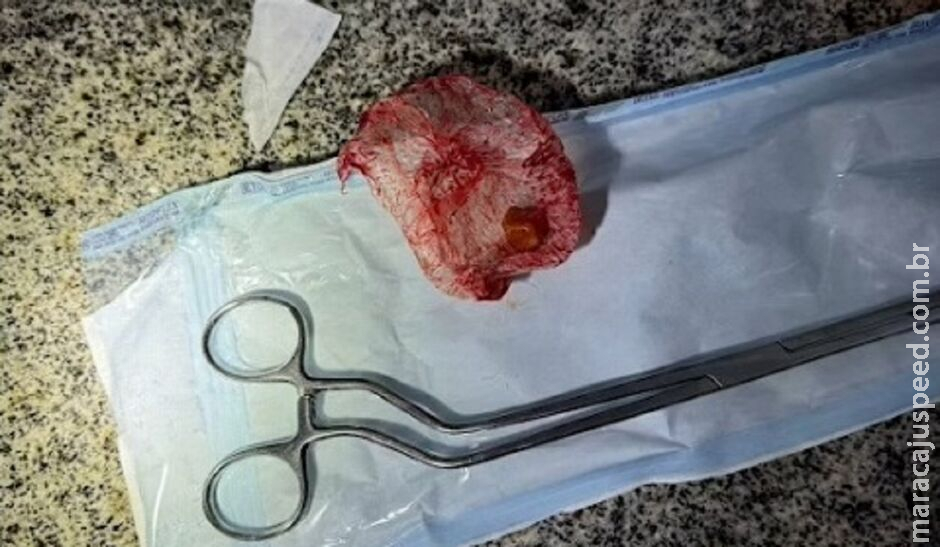 Mulher tenta esconder droga em genitália, mas é presa com marido em Chapadão do Sul Mulher tenta esconder droga em genitália, mas é presa com marido em Chapadão do Sul