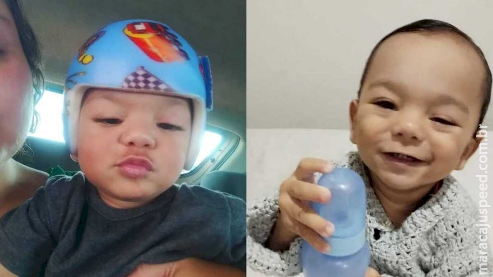 Bebê precisa de R$ 10 mil para tratar plagiocefalia em Três Lagoas; SUS não cobre Bebê precisa de R$ 10 mil para tratar plagiocefalia em Três Lagoas; SUS não cobre