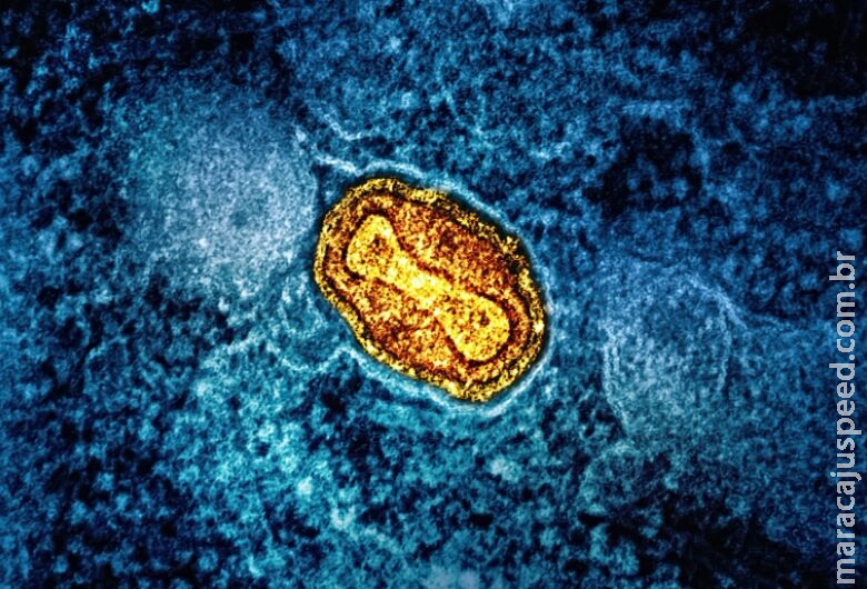 Mpox: OMS pede resposta após registro de nova variante na Suécia Mpox: OMS pede resposta após registro de nova variante na Suécia