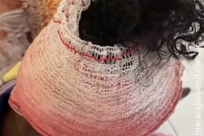 Mulher é agredida com cadeirada na cabeça pelo namorado em Dourados Mulher é agredida com cadeirada na cabeça pelo namorado em Dourados