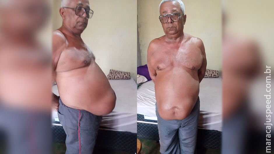 Família arrecada brindes para bingo beneficente para cirurgia de hérnia de tratorista em Terenos Família arrecada brindes para bingo beneficente para cirurgia de hérnia de tratorista em Terenos