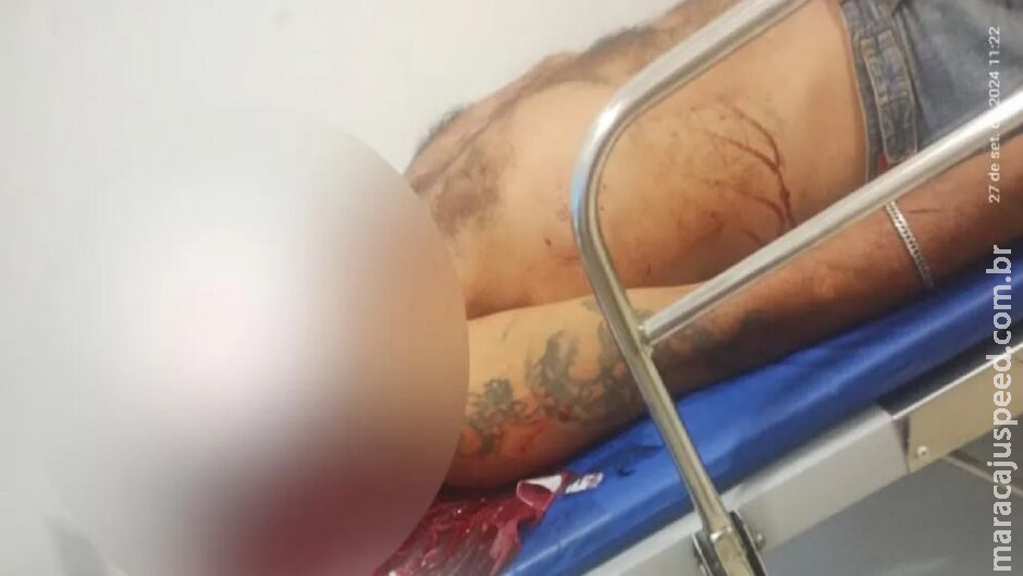 Levando dinheiro aos filhos, homem é atacado com tijolada pelo atual da ex em Três Lagoas Levando dinheiro aos filhos, homem é atacado com tijolada pelo atual da ex em Três Lagoas