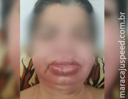‘Me sinto lesada’: Terceira vítima que sonhou com ‘bocão’ se esconde em casa há 6 dias ‘Me sinto lesada’: Terceira vítima que sonhou com ‘bocão’ se esconde em casa há 6 dias