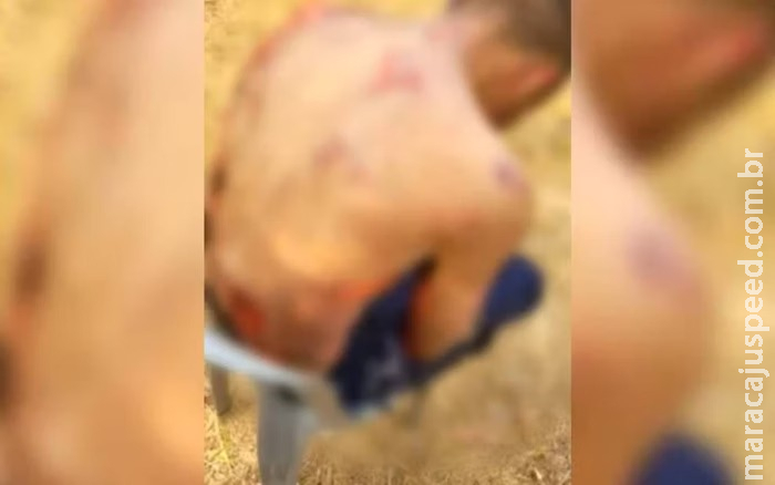 Morre homem queimado por dono de supermercado após suspeita de furto