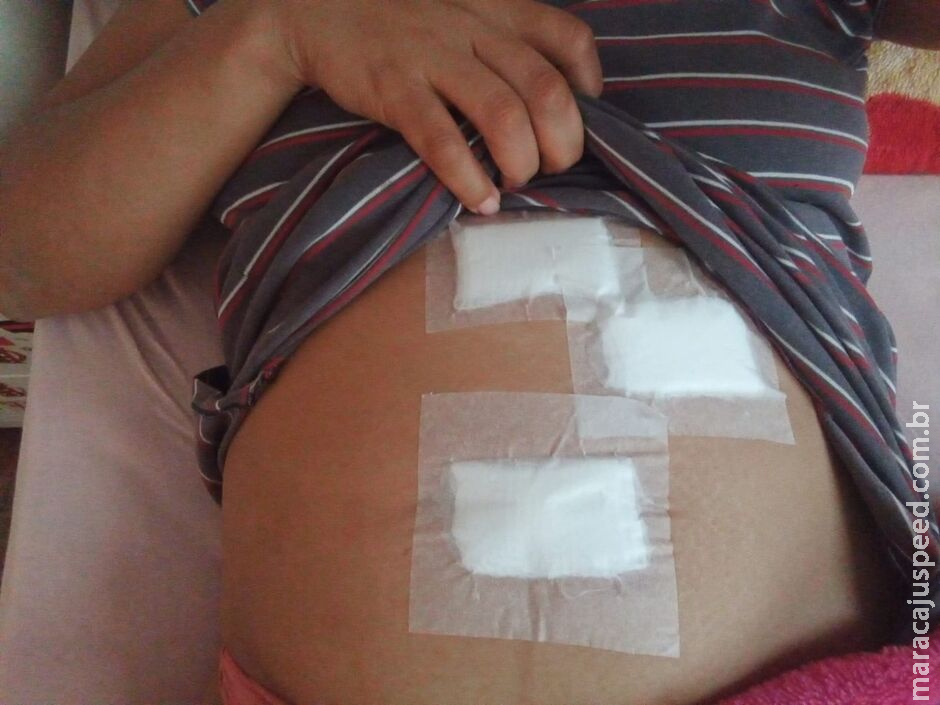 Diarista recém-operada precisa de ajuda para fazer pastelada e pagar aluguel em Campo Grande Diarista recém-operada precisa de ajuda para fazer pastelada e pagar aluguel em Campo Grande