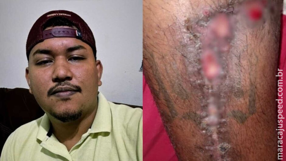 Jovem com tumor na perna faz rifa para ajudar no tratamento em Sidrolândia Jovem com tumor na perna faz rifa para ajudar no tratamento em Sidrolândia