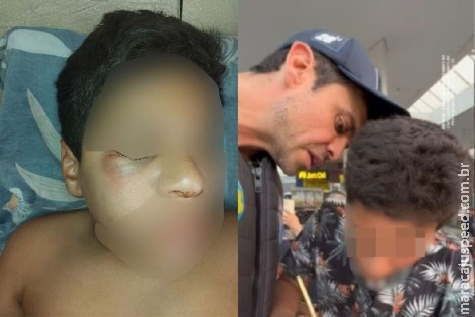 Menino que Marçal expôs por "não saber escrever" é agredido na escola Menino que Marçal expôs por "não saber escrever" é agredido na escola