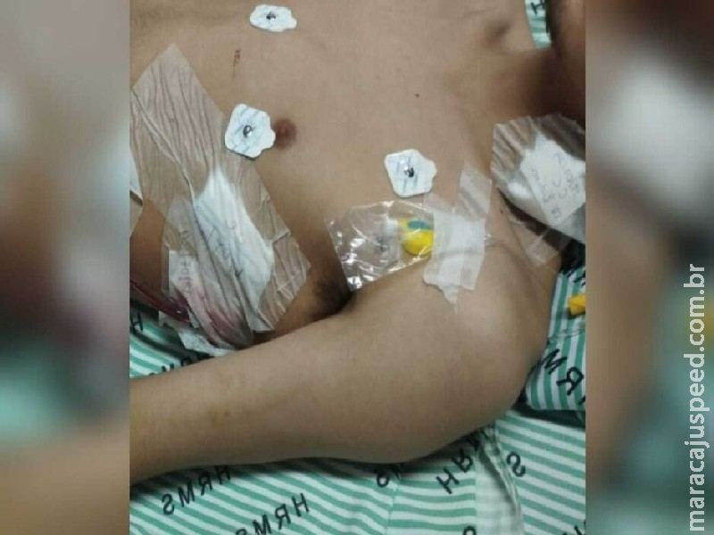 Jovem que perdeu pulmão se arrepende do uso de Jovem que perdeu pulmão se arrepende do uso de
