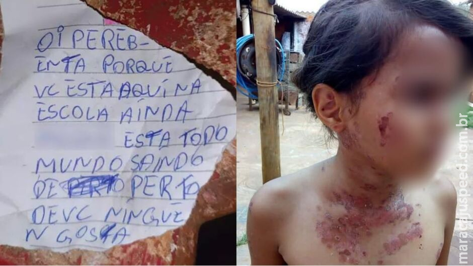 Apesar de bilhetes, Justiça arquiva processo de criança que sofreu bullying por doença rara Apesar de bilhetes, Justiça arquiva processo de criança que sofreu bullying por doença rara