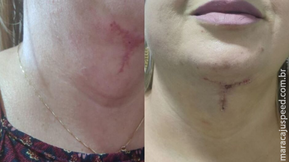 Dentista acusada de erros graves se defende e nega irregularidades: Dentista acusada de erros graves se defende e nega irregularidades: