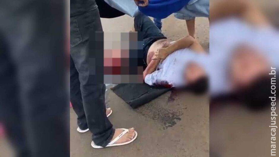 Motociclista tem perna dilacerada em acidente grave com caminhão em Campo Grande Motociclista tem perna dilacerada em acidente grave com caminhão em Campo Grande