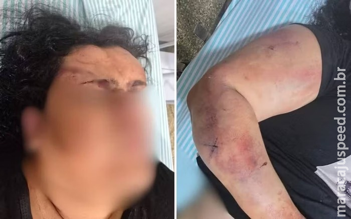 Homem é preso por agredir a companheira com pedaço de pau com pregos Homem é preso por agredir a companheira com pedaço de pau com pregos