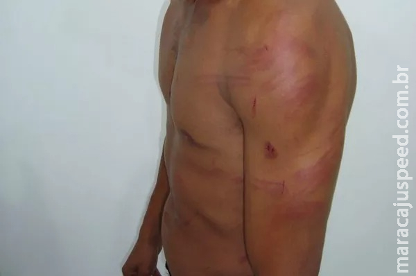 Policial aposentada agride marido com pauladas durante discussão no Aero Rancho Policial aposentada agride marido com pauladas durante discussão no Aero Rancho