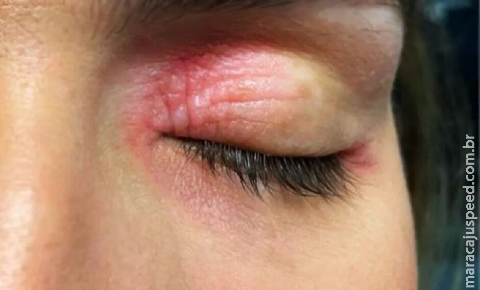 Ao anunciar que sairia de casa, mulher é agredida pelo marido em Três Lagoas Ao anunciar que sairia de casa, mulher é agredida pelo marido em Três Lagoas