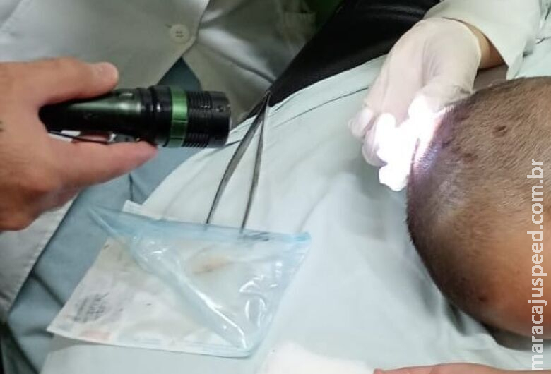 Criança com larvas na cabeça é internada para tratamento em Dourados Criança com larvas na cabeça é internada para tratamento em Dourados